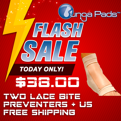 Flash Sale - Lace Bite Pads and Free Shipping