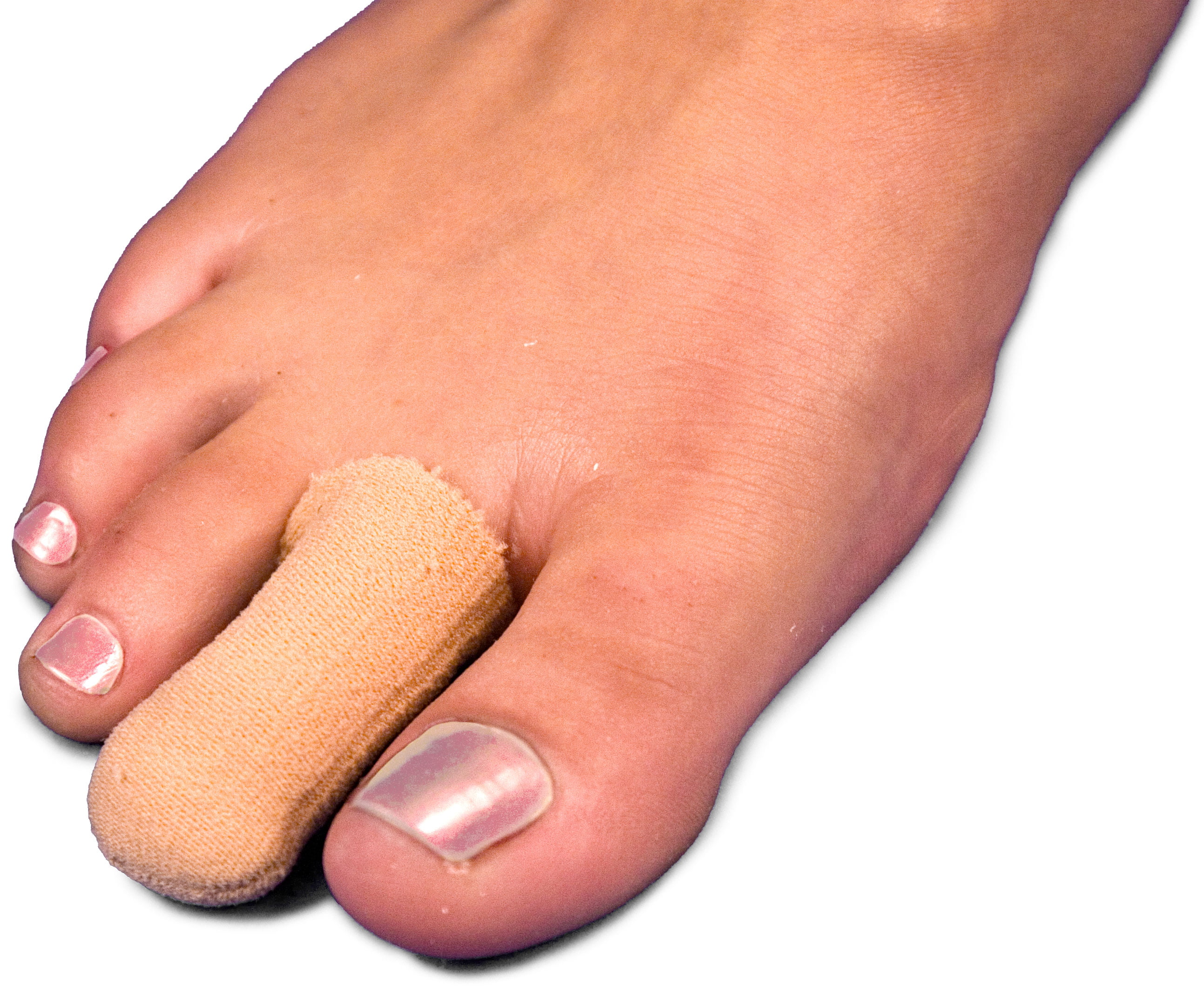 Nail Fungus - Podiatrist in Toronto, ON | Sheldon H. Nadal, D.P.M.