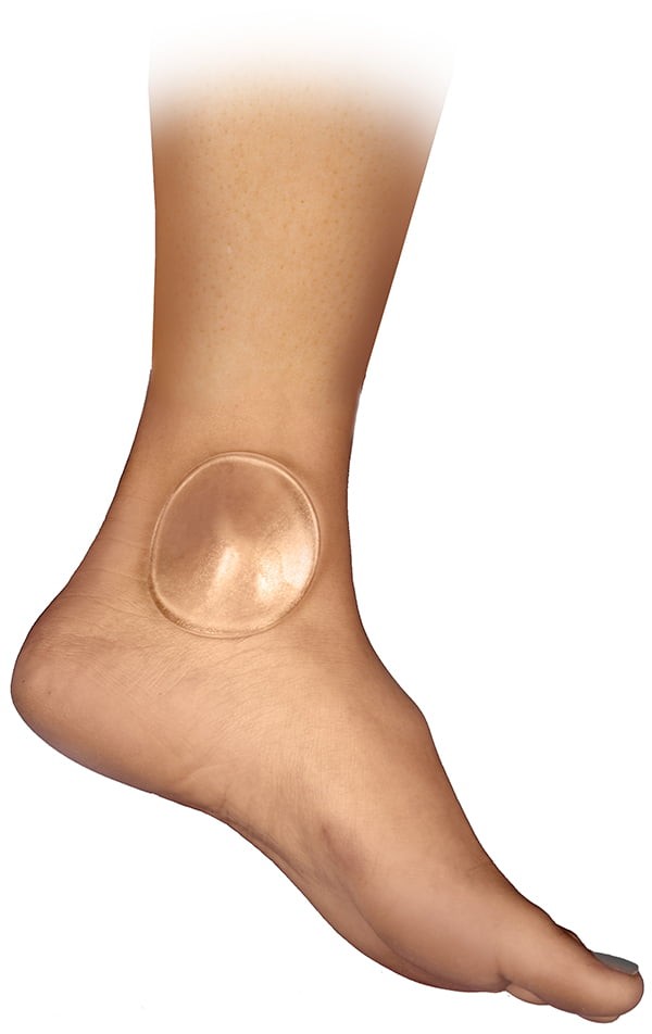 Bunga Pads® Gel Disc – Gel Padding for Pressure Points